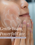 Gentle Aloe Soap