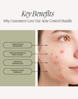 Acne Control Bundle