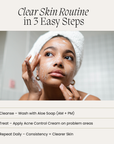 Acne Control Bundle