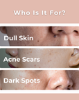 Melasma Rejuvenating Night Cream