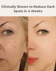 Dark Spot Defense Bundle