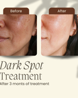 Dark Spot Night Reset Bundle