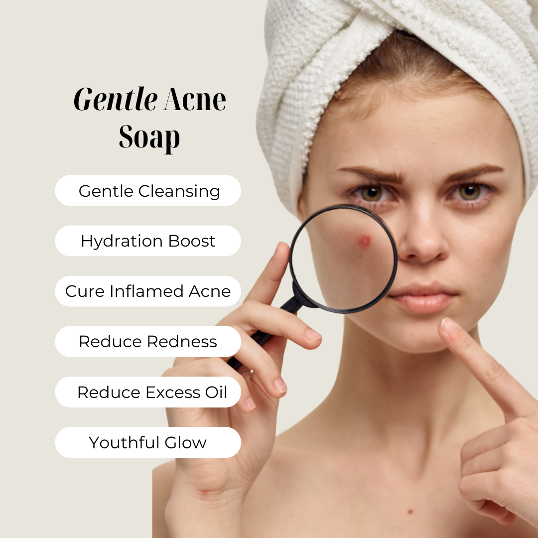 Gentle Aloe Soap
