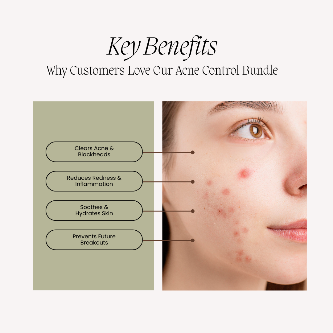 Acne Control Bundle