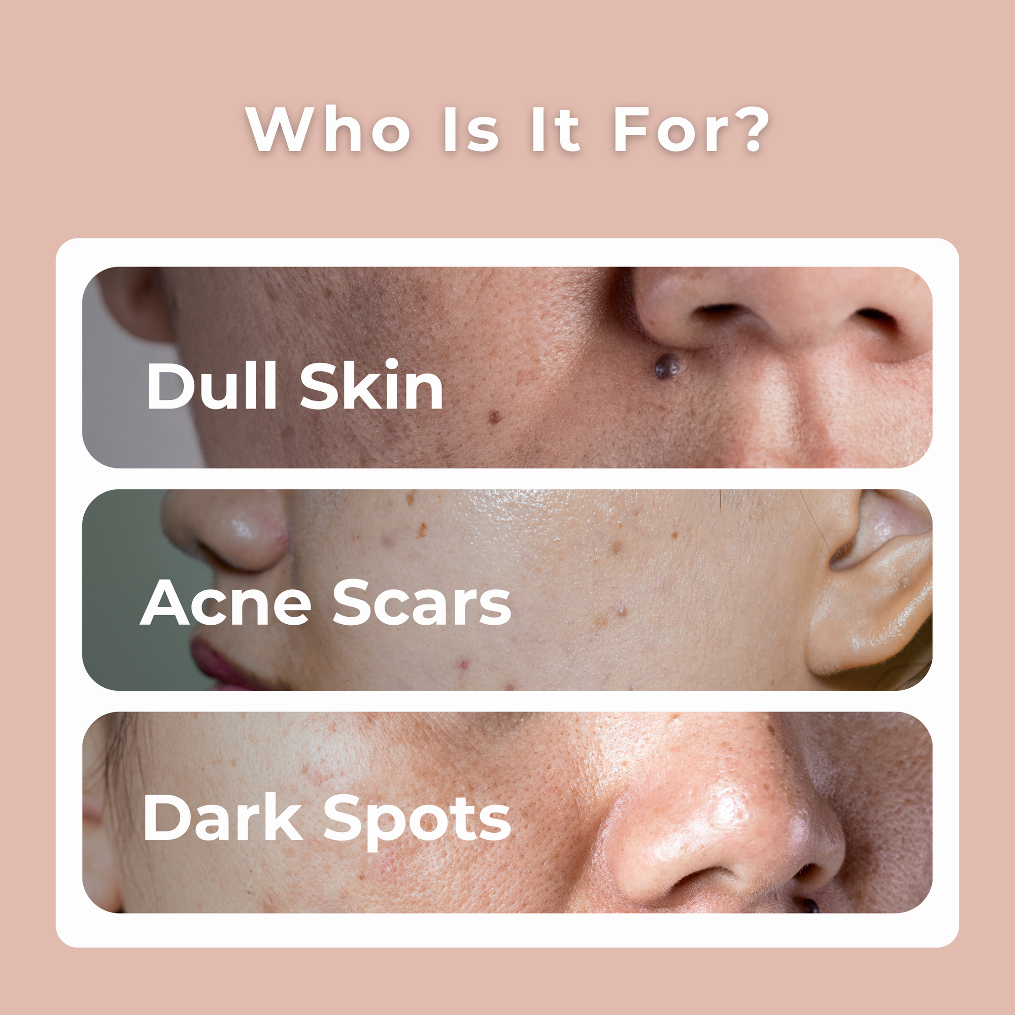 Melasma Rejuvenating Night Cream