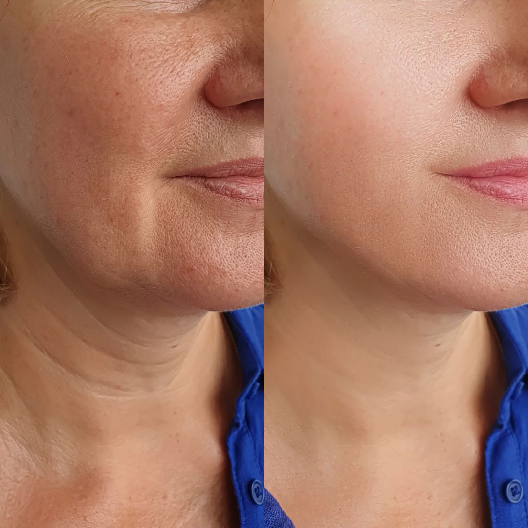 Age-Defying Foam Cleanser