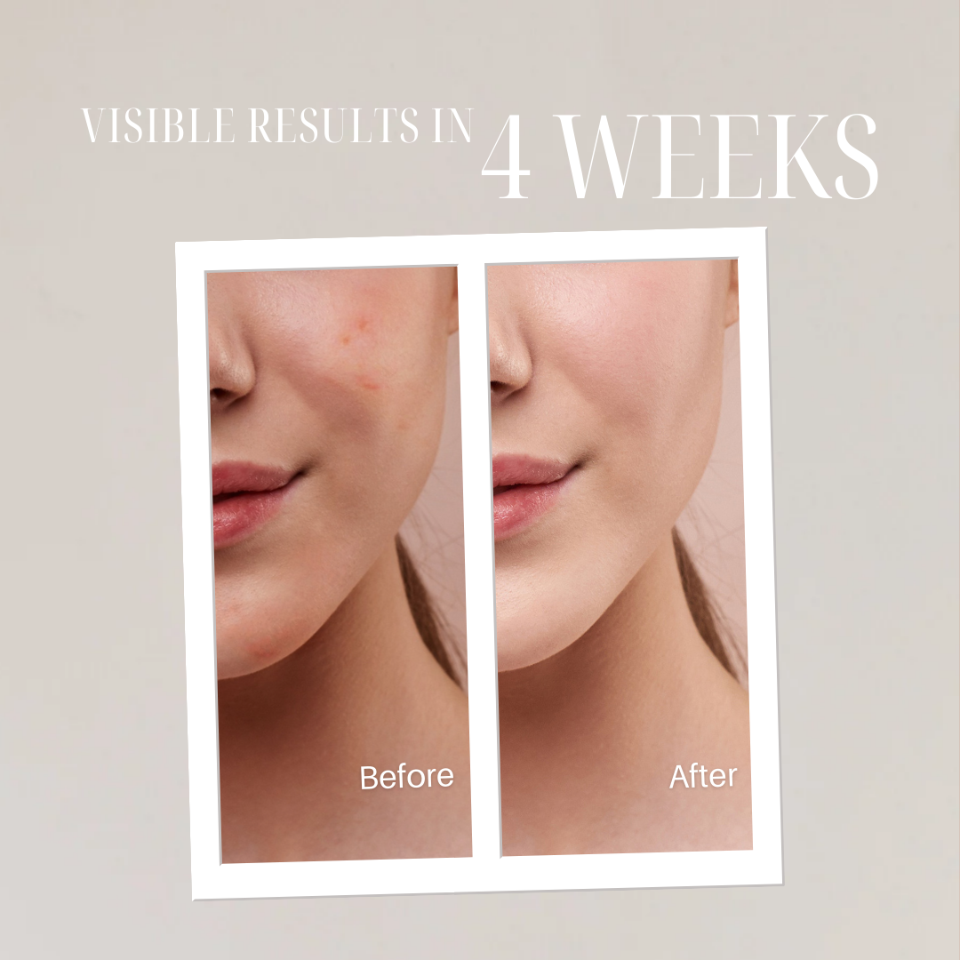 Niacinamide Brightening Essence