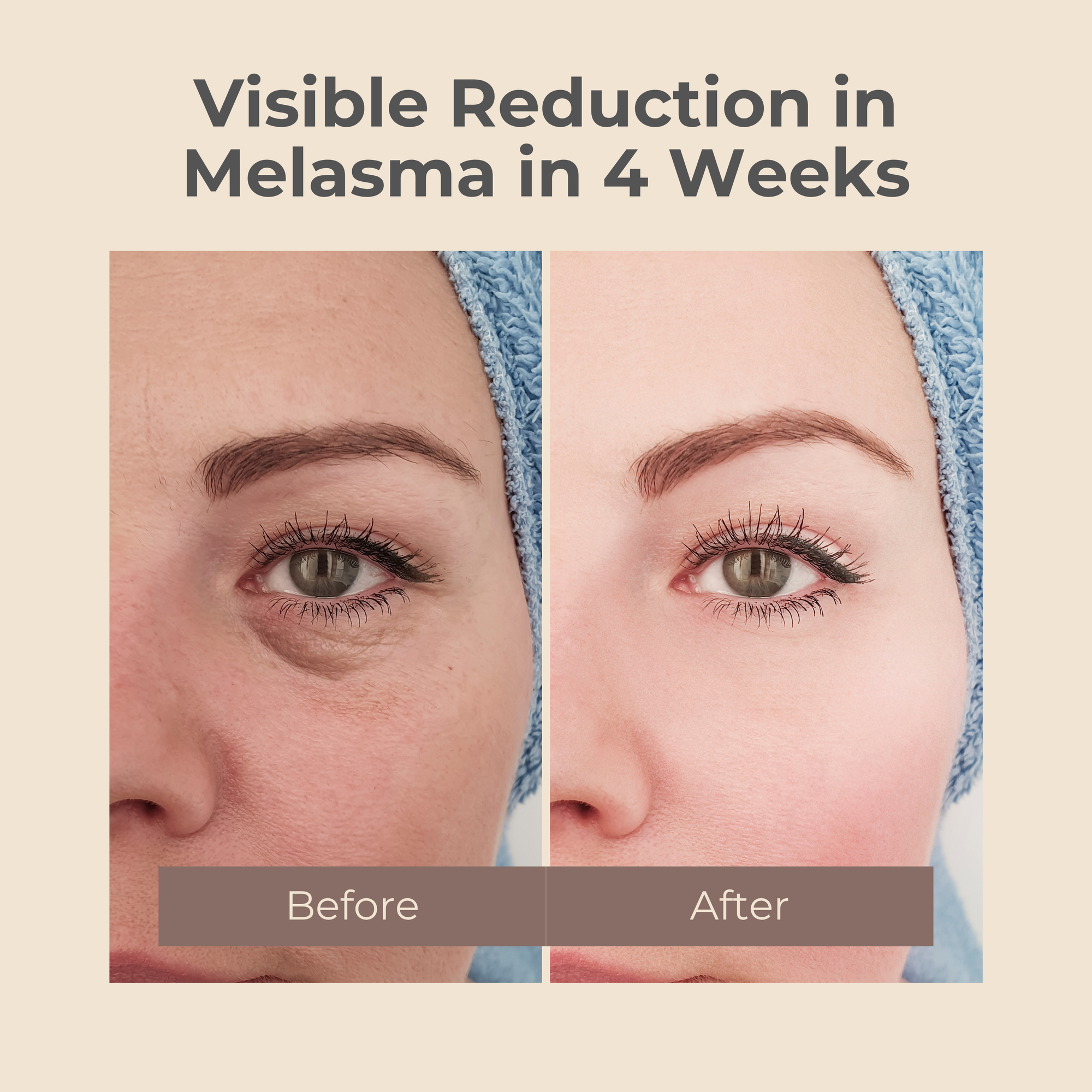 Melasma Rejuvenating Night Cream