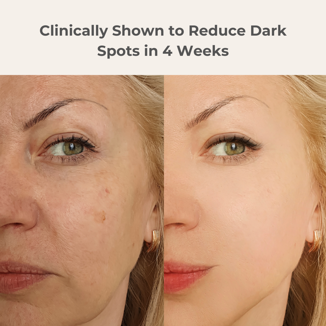 Dark Spot Defense Bundle