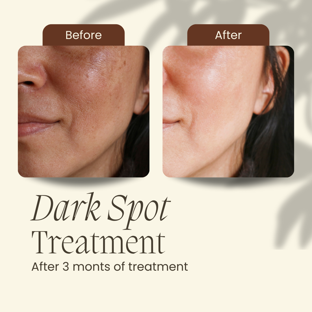Dark Spot Night Reset Bundle