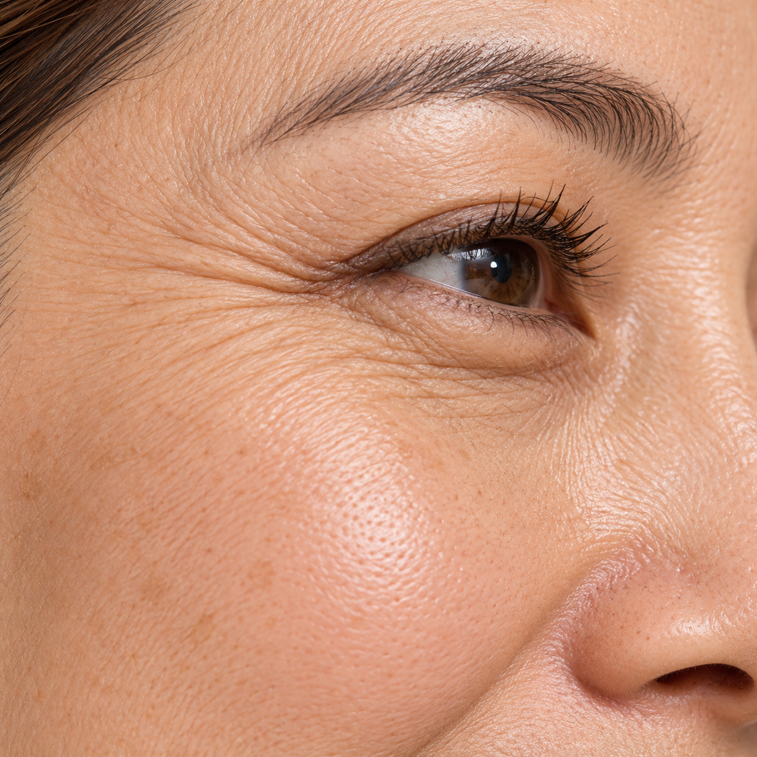 Fine Lines & Wrinkles